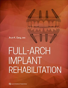 Full Arch Implant Rehabilitation PDF