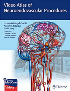 Download Video Atlas of Neuroendovascular Procedures Free