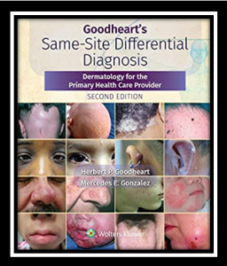 Goodheart's Same-Site Differential Diagnosis PDF