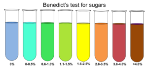 Benedict’s Test