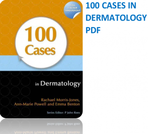 100 cases in dermatology pdf