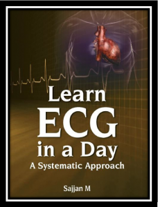 learn ecg in a day: a systemic approached pdf
