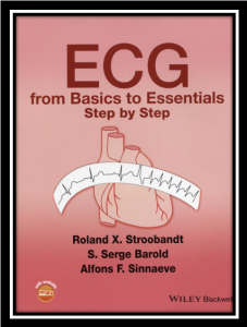 ecg from basics to essentials step by step pdf