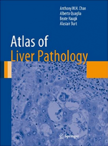 Download Atlas of Liver Pathology PDF Free