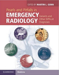 Download Pearls and Pitfalls in Emergency Radiology PDF Free