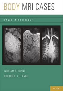Download Body MRI Cases: Cases in Radiology PDF Free