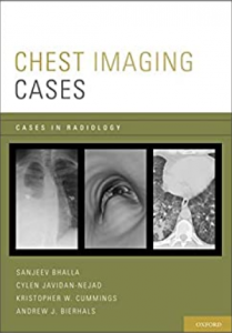 Download Chest Imaging Cases PDF Free