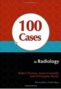 Download 100 Cases in Radiology PDF Free