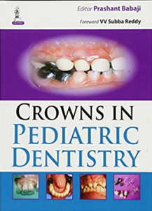 Download Crowns in Pediatric Dentistry PDF Free