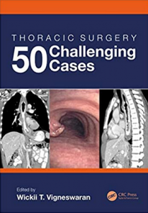 Download Thoracic Surgery: 50 Challenging cases PDF Free