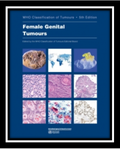 WHO Classification of Tumours Female Genital Tumours 5th Edition PDF