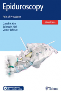 Epiduroscopy Atlas of Procedures PDF