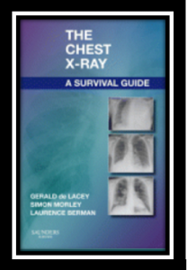 The Chest X-Ray A Survival Guide PDF