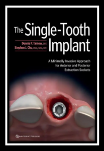 The Single-Tooth Implant PDF