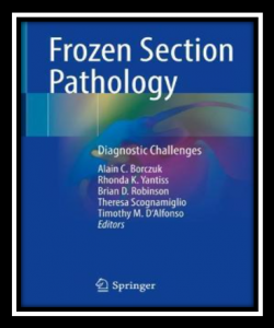 Frozen Section Pathology Diagnostic Challenges PDF