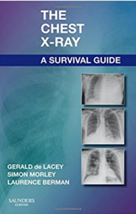 Download The Chest X-Ray A Survival Guide PDF 