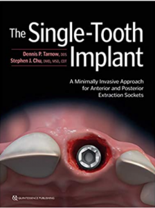 Download The Single-Tooth Implant PDF Free