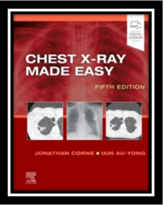 Chest X-Ray Made Easy PDF
