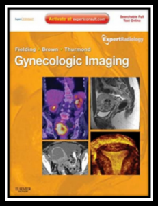 Gynecologic Imaging PDF