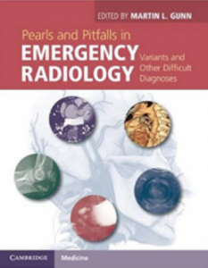 Pearls and Pitfalls in Emergency Radiology PDF