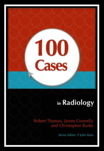 100 Cases in Radiology PDF