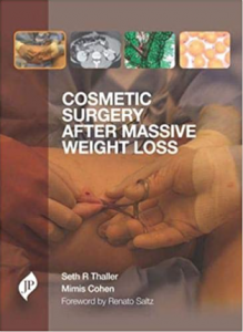 Download Cosmetic Surgery after Massive Weight Loss PDF Free