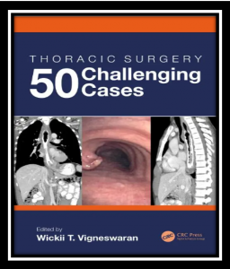 Thoracic Surgery: 50 Challenging cases PDF