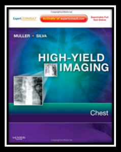 High-Yield Imaging Chest PDF