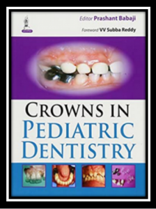 Crowns in Pediatric Dentistry PDF