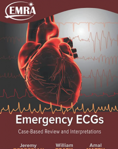 Emergency ECGs Case-Based Review and Interpretations pdf