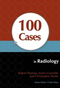 100 cases in radiology pdf