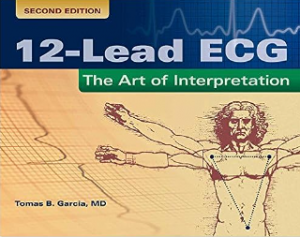 12-lead ECG: the art of interpretation pdf