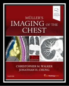 Muller's Imaging of the Chest 2nd edition pdf