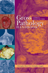 Gross Pathology Handbook A Guide to Descriptive Terms pdf 