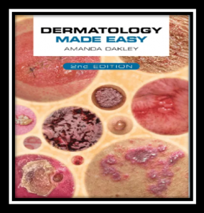 Dermatology Made Easy PDF