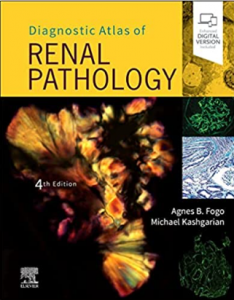 Diagnostic Atlas of Renal Pathology PDF