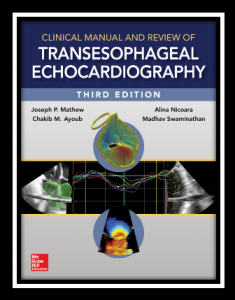 Clinical Manual and Review of Transesophageal Echocardiography 3rd Edition PDF