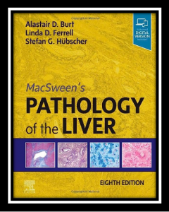 MacSween's Pathology of the Liver 8th Edition PDF