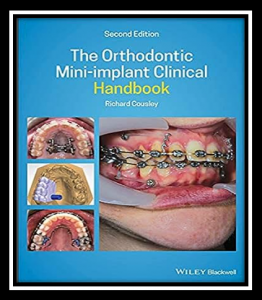 The Orthodontic Mini-implant Clinical Handbook PDF