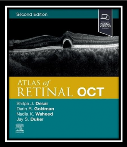 Atlas of Retinal OCT 2nd edition PDF