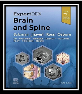 ExpertDDx: Brain and Spine PDF