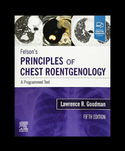 Felson's Principles of Chest Roentgenology A Programmed Text 5th Edition PDF
