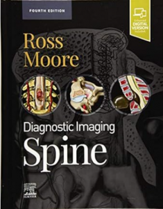 Rose Moore Diagnostic Imaging Spine