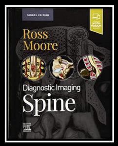 Rose Moore Diagnostic Imaging Spine PDF