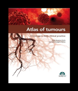 Atlas of tumours. Oncology in daily clinical practice PDF