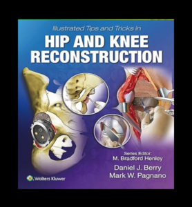 Illustrated Tips and Tricks in Hip and Knee Reconstructive and Replacement Surgery