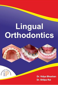 Lingual Orthodontics pdf