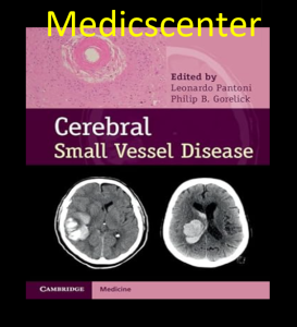 Cerebral Small Vessel Disease