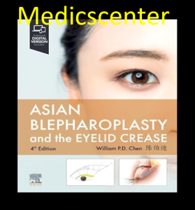 Asian Blepharoplasty and the Eyelid Crease 4th Edition