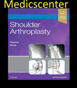 Shoulder Arthroplasty 2nd Edition
